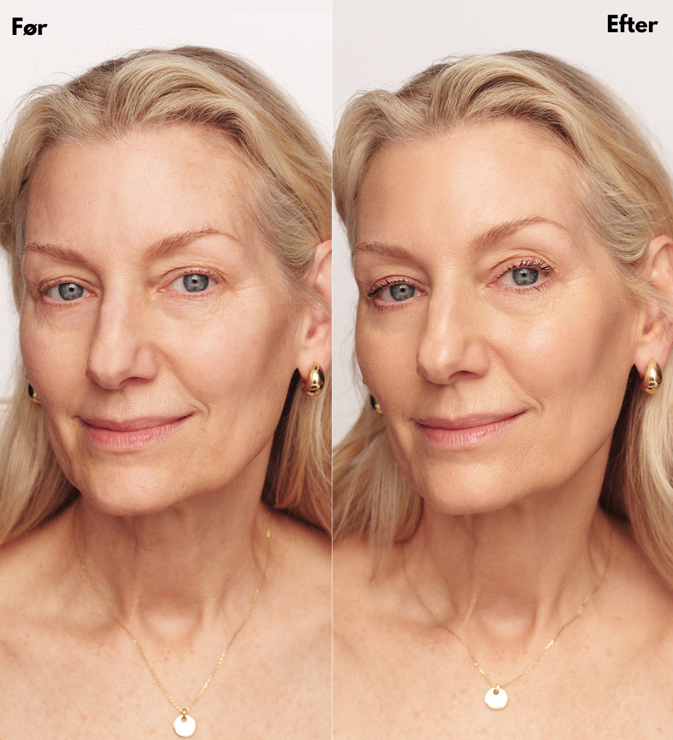 Celora | Changing Foundation
