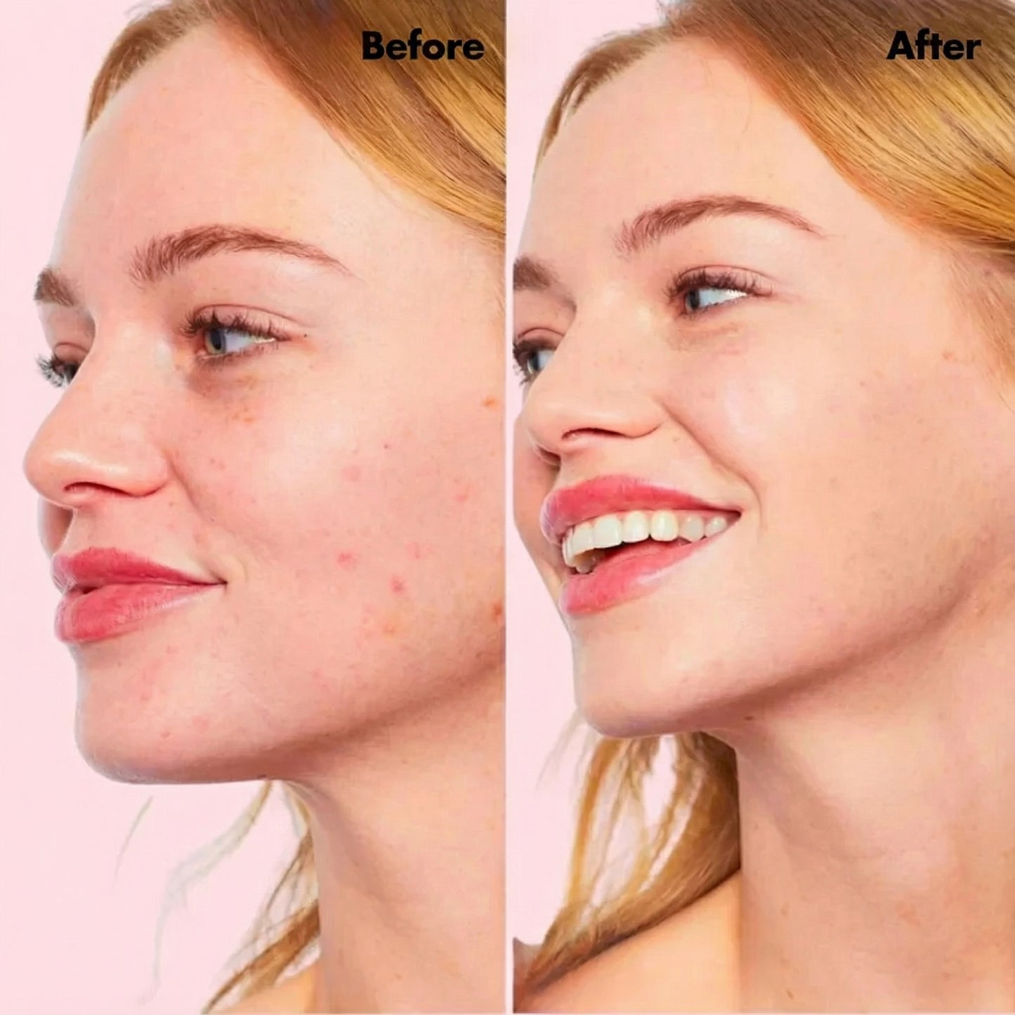 Celora | CC Cream Red Correct