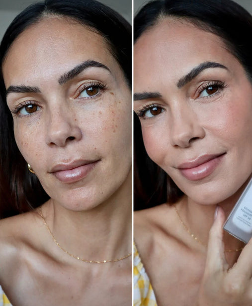 Celora | Changing Foundation