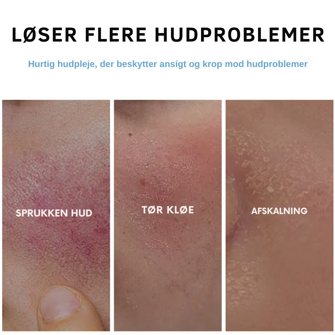 Celora blød barriere fugtighedscreme