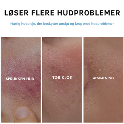 Celora blød barriere fugtighedscreme