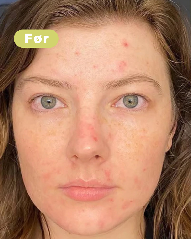 Voor foto - Maria L, 32