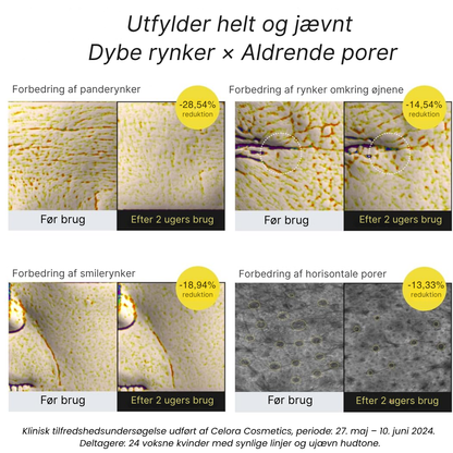 Celora Retinal Confidence Booster