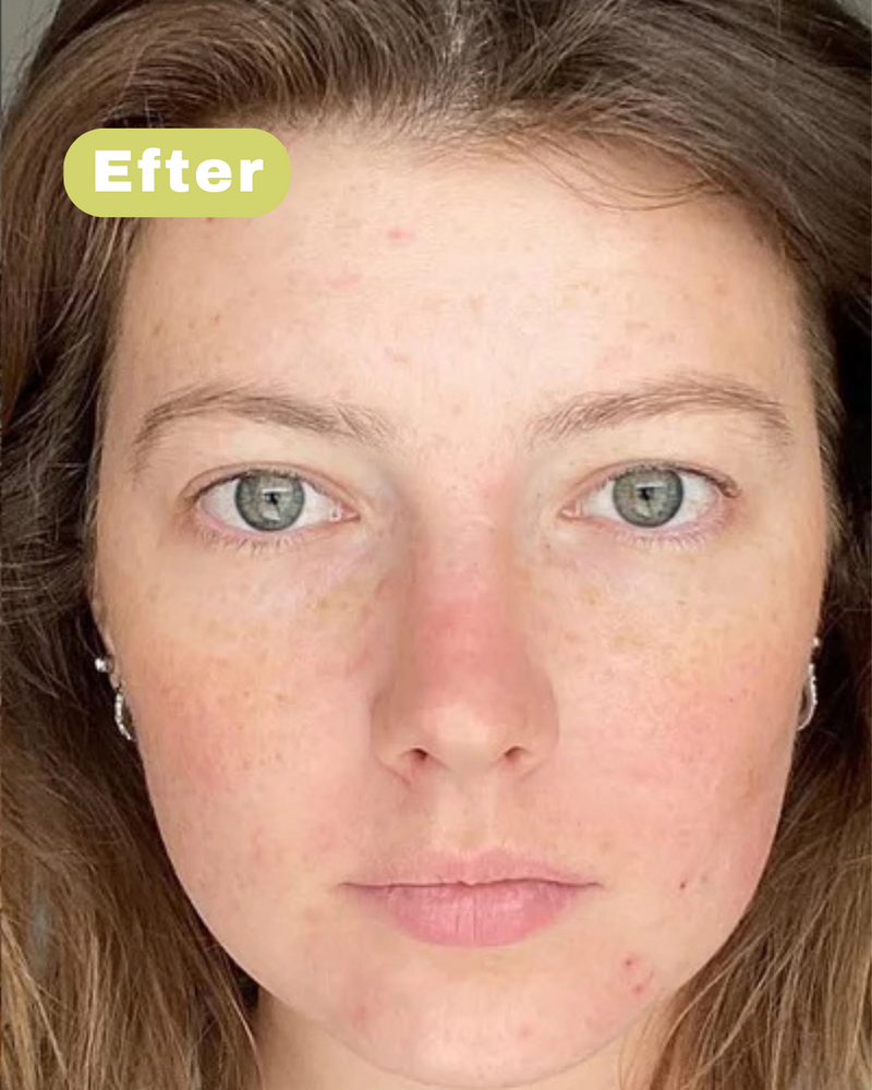 Na foto - Maria L, 32