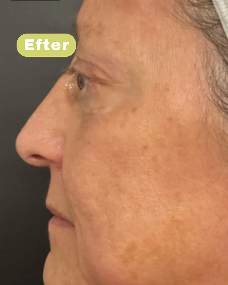 Na foto - Lindy K, 51