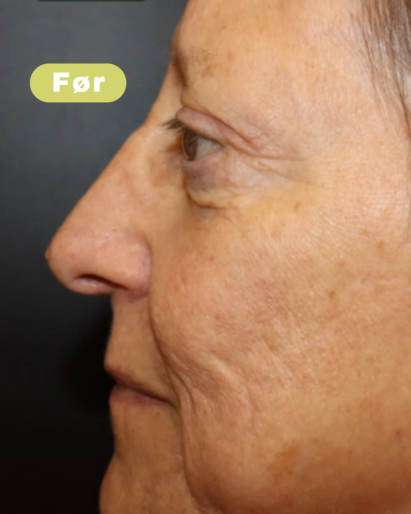 Voor foto - Lindy K, 51