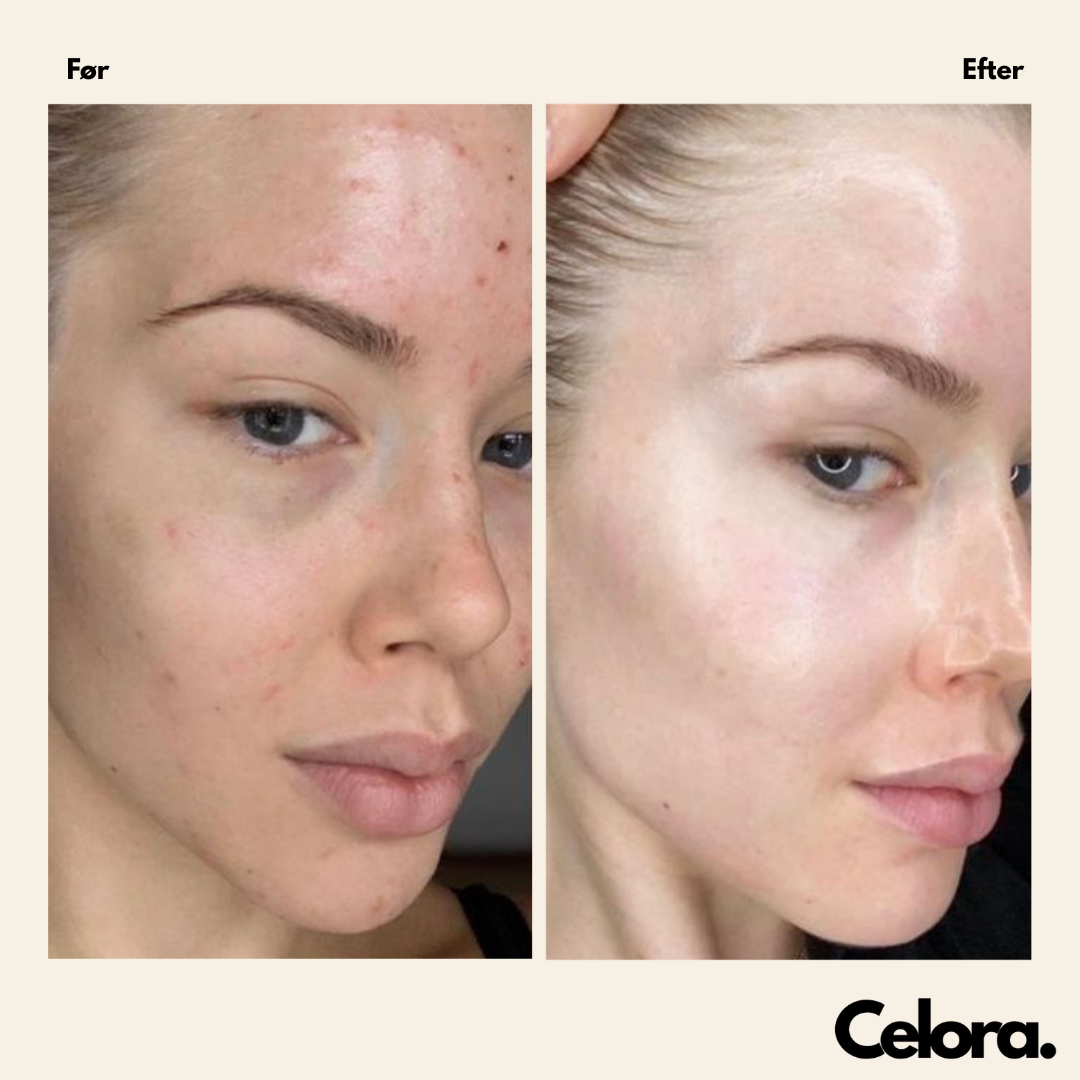 Korean Callogen Deep Face Mask