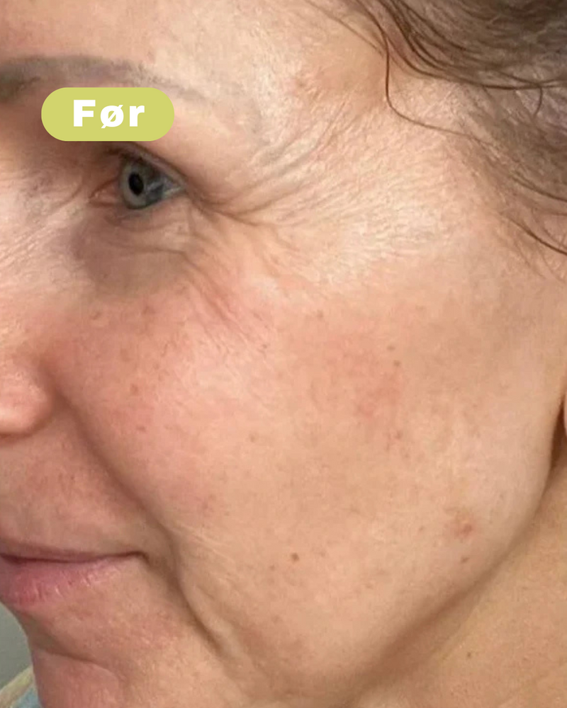 Voor foto - Anna J, 46