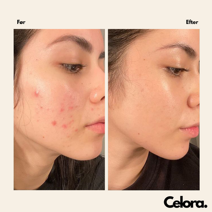 Korean Callogen Deep Face Mask