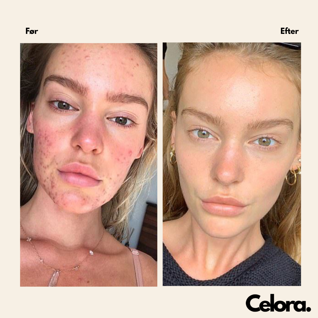 Korean Callogen Deep Face Mask