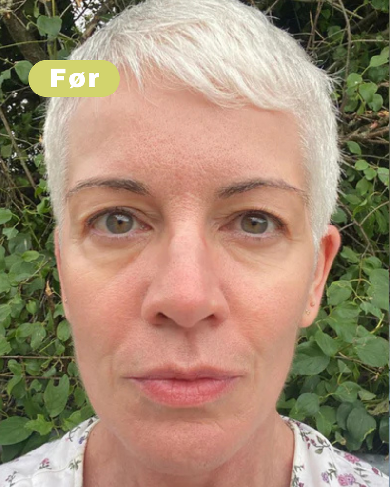 Voor foto - Emma I, 43