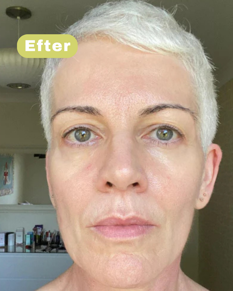 Na foto - Emma I, 43