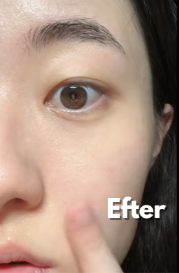 Na foto - Tilstoppede porer