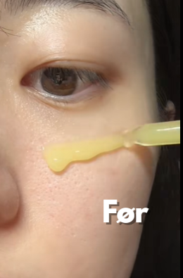 Voor foto - Tilstoppede porer