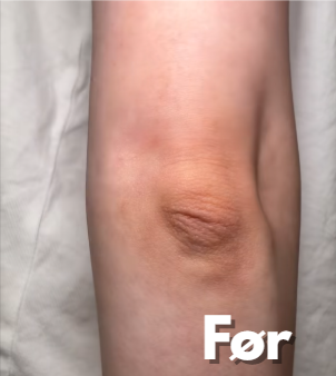 Na foto - Mørke pletter