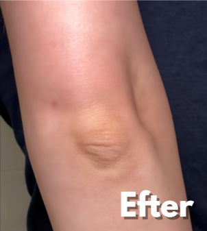 Voor foto - Mørke pletter