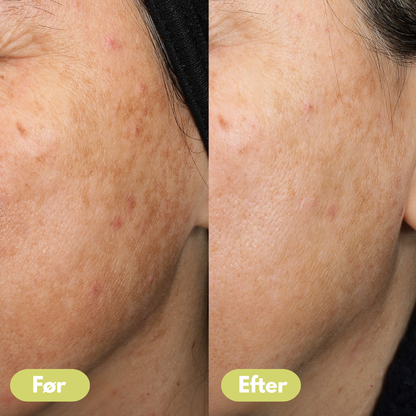 Celora Retinal Confidence Booster