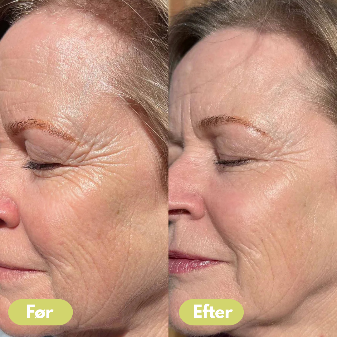 Celora Retinal Confidence Booster