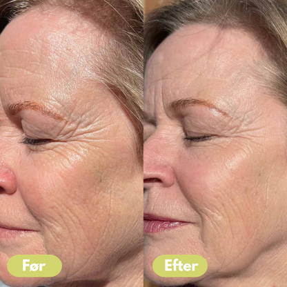 Celora Retinal Confidence Booster